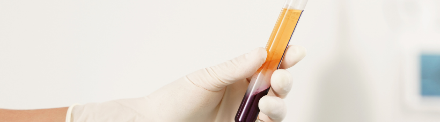 ProbÃ³wki do izolacji osocza