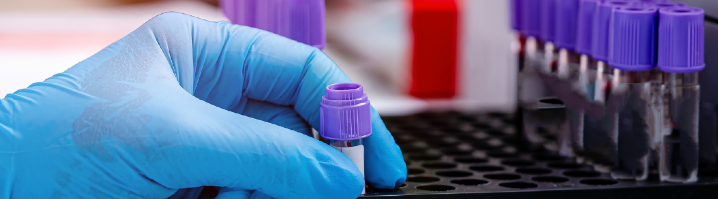 Rola badan hematologicznych w trosce o zdrowie