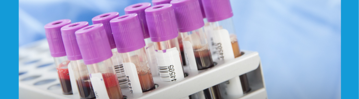 PodciÅnieniowy system do pobierania krwi