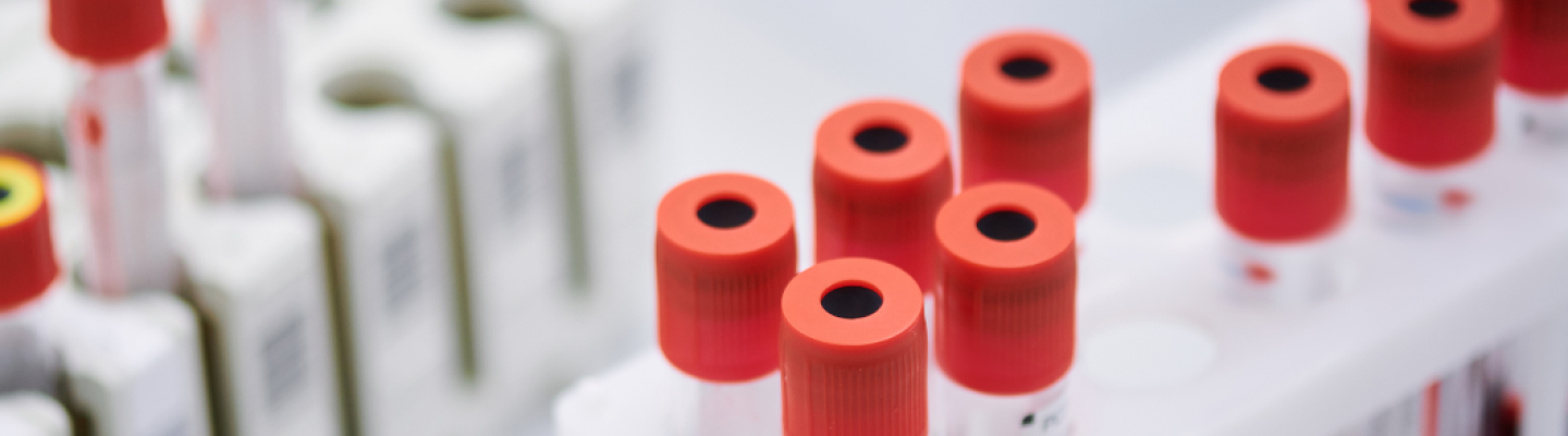 Kulisy laboratorium badaÅ krwi