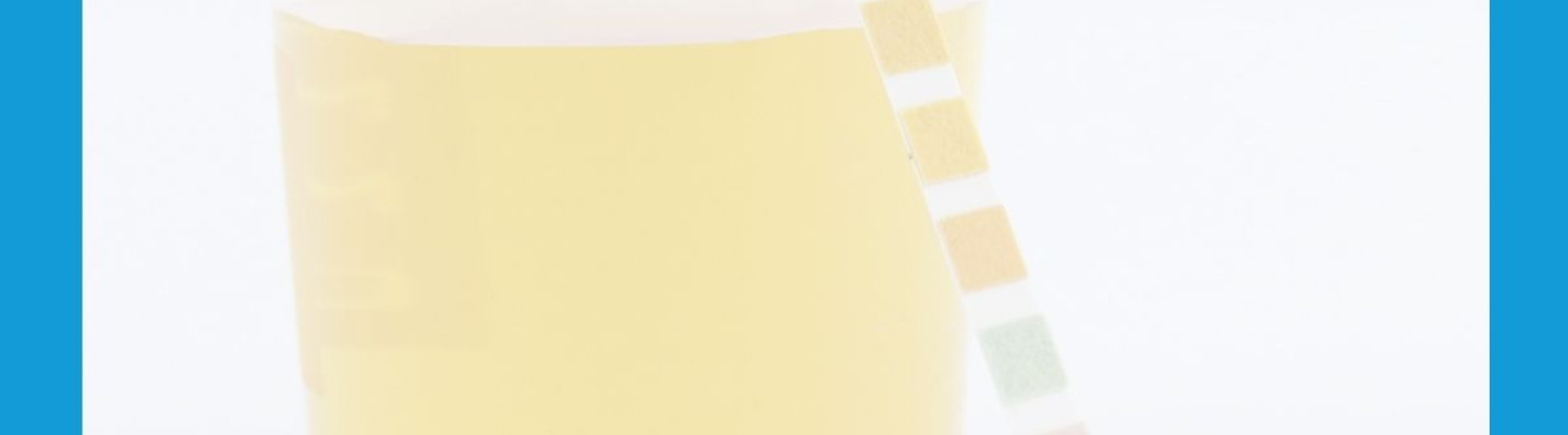 Osad moczu â znaczenie kliniczne