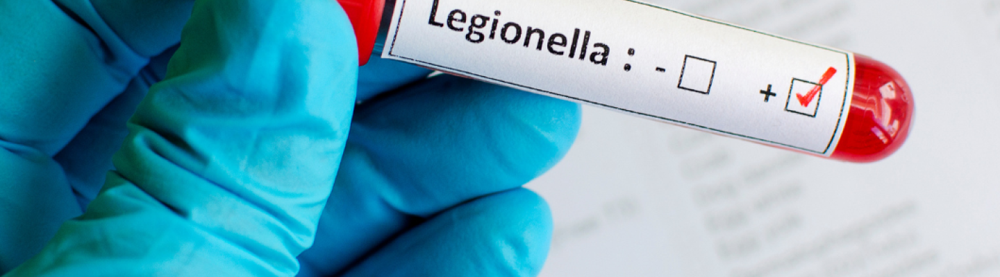 Legionella: Kompleksowy przewodnik po bakterii, chorobach i profilaktyce